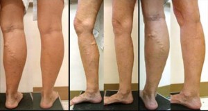 before-after