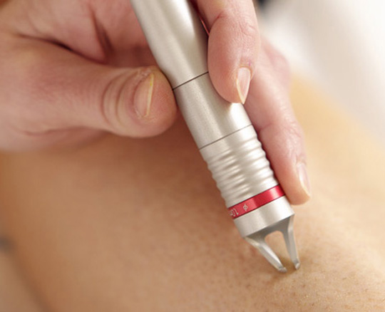 Chicago Vein Specialists at Chicago Vein Care Center Release a New Article on Different Vein Disease Conditions